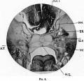 Fig. 8. Coronal section of a 19 mm Embryo