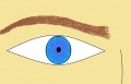 Figure 7: Stellate Iris. This image shows a typical eye of an individual with Williams Syndrome showing the stellate iris.