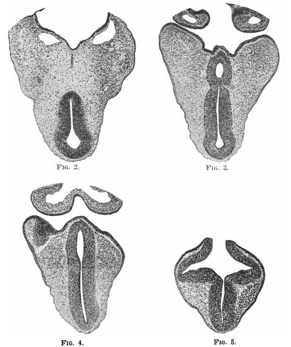 Fig.2, 3, 4 and 5. Sections through head.