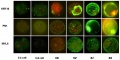 Bovine blastocyst KRT18, FN1 and MYL6 expression