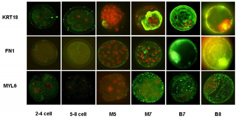 File:Bovine blastocyst KRT18, FN1 and MYL6 expression.jpg