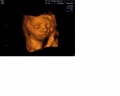 Ultrasound technology is able to note any abnormal facial features