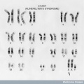 Z3289829 - Karyotype is relavent to group topic. Legend does explain what the image is about. I do not like the use of Wellcome images in these projects. You should have attempted to source a research image. The URL link is very clumsy.