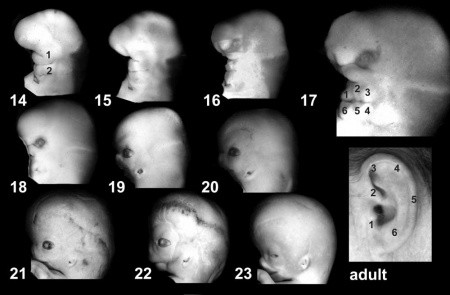 Sensory - Hearing and Balance Development - Embryology