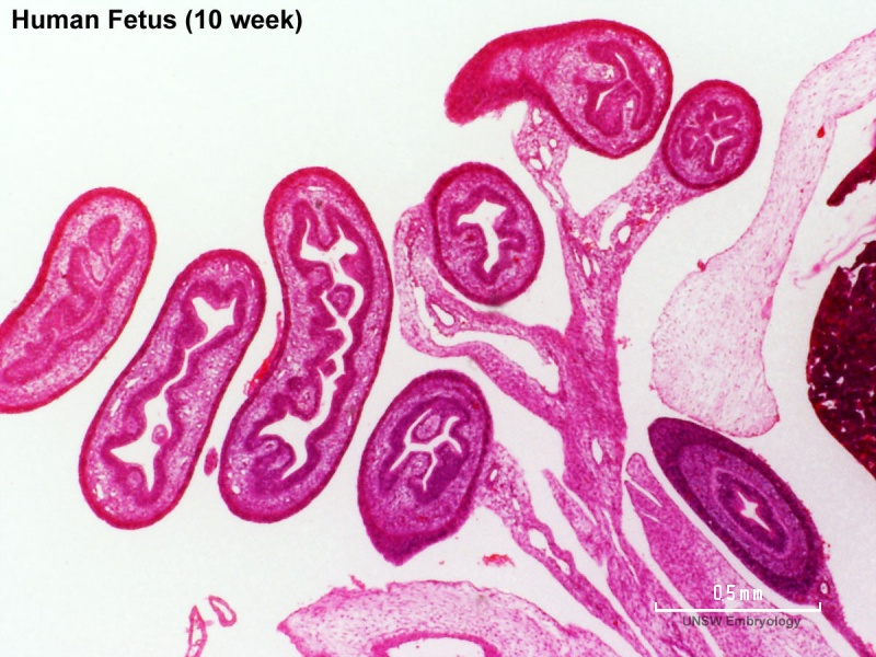 File:Human week 10 fetus 06.jpg