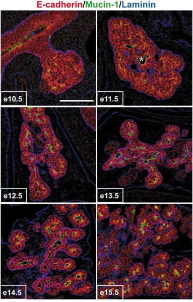File:Mouse pancreas development.jpg