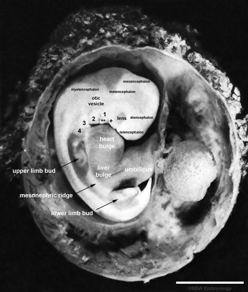 File:Stage17 embryo and membranes03.jpg