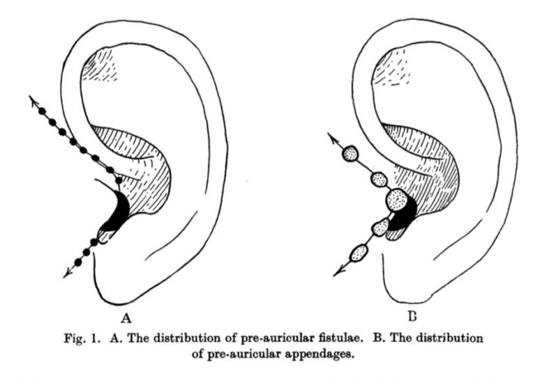 File:Wood-Jones1934 fig01.jpg
