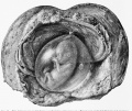 31 Human Embryo 5.5 cm