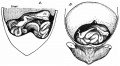 embryo 45 mm