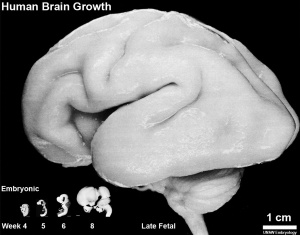 Brain size embryonic (week 4, 5, 6, and 8) and late fetal (third trimester)