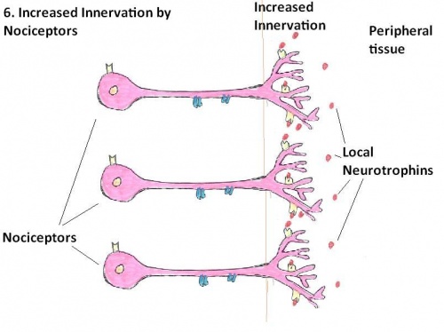 Increased Innervation of peripheral Tissues by Nociceptors