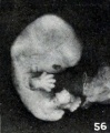 Figs. 52-63. Illustrating the absence of fundamental differences between the group of fetus compressus and grade 3 of the normal specimens. No. 1750 (fig. 56) normal. X1.5. (To be compared with No. 1806, fig. 43.)