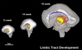 Brain tract development 06.jpg