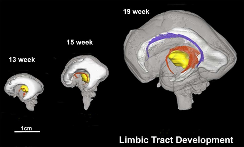 File:Brain tract development 06.jpg