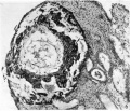 Fig. 6. The Macafee ovum in situ.