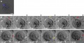 Mouse - Spermatozoa Swims within the Previtelline space (PVS) Prior to Fertilization