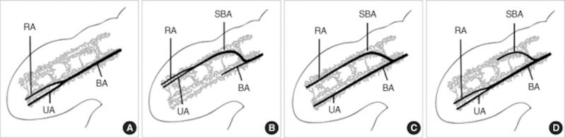 File:Embryonic upper limb - brachial and superficial brachial artery.jpg