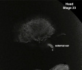 Stage23 MRI S01-ear.jpg