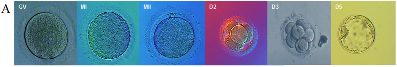 File:Stages in early development of a human zygote.png