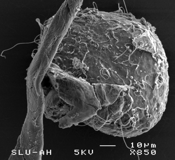 Cat spermatozoa bound to oocyte zona pellucida.jpg