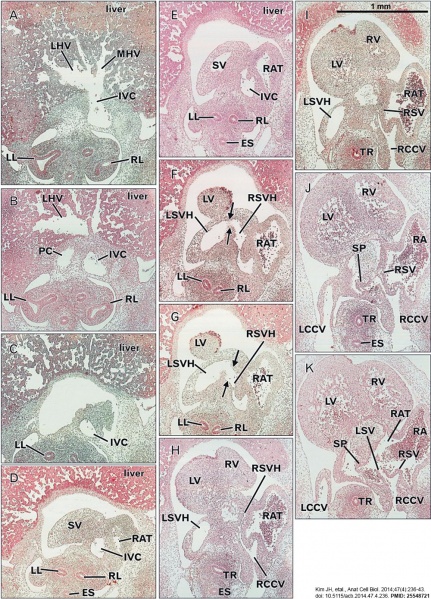 File:Heart human embryo CRL10mm 01.jpg