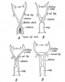 Fig. 88. Evolution of the Human Form of Uterua. A Form seen in lowest mammals, reptiles, amphibians, fishes, and in the 2nd month human foetus. B. Form of Mullerian Ducts in rodents. C. Form in Camivora, etc., and in the 4th month human foetus. D. Form found in man and higher primates.