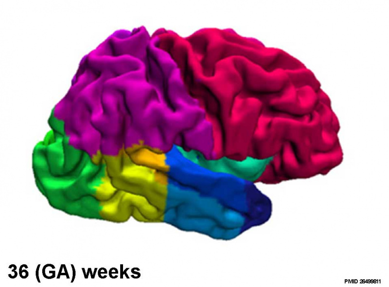 File:Fetal brain MRI03.jpg