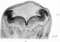 Fig. 13. Transverse section through the early medulla showing the rhombic lip. r.l. Rhombic lip. G.x. Ganglion of the vagus.