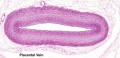 Placental vein