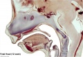 Fetal head section (12 weeks)