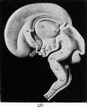 Fig. 26. Mesial section of the brain of a human embryo of the third month (model).