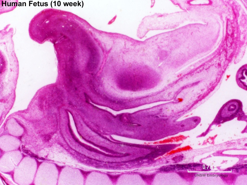 File:Human week 10 fetus 03.jpg