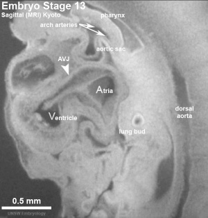 MRI sagittal image of embryo Carnegie stage 13