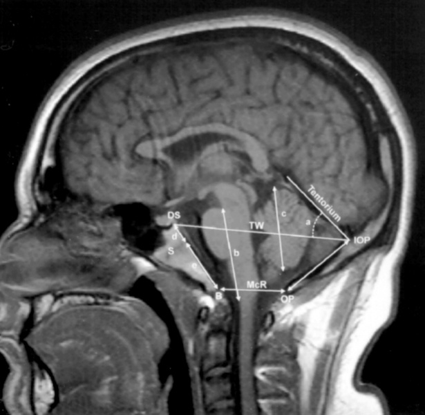 File:Human- adult brain MRI.jpg