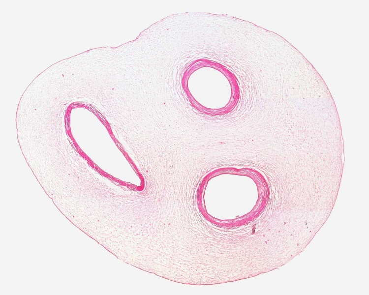 File:Placenta histology 001.jpg