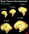 Three-dimensional reconstruction of the lateral (top row) and medial (bottom row) surface of 13–21 week brains to reveal the development of the Sylvian or lateral fissure (green arrow).