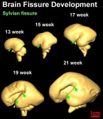 Brain fissure development