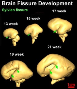 Brain fissure development 03.jpg