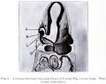 Fig. 3. Section through head of Foetal Pig, 2 mm long.