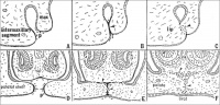 Comparison of morphogenesis of the upper lip with the palate.jpg