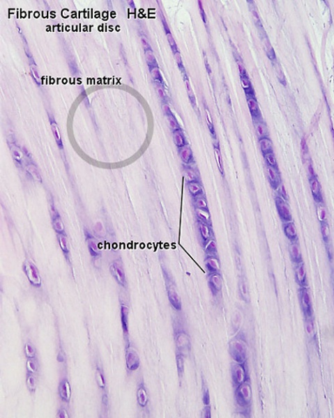 File:Fibrous cartilage 01.jpg