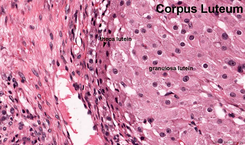 File:Ovary corpus luteum 02.jpg