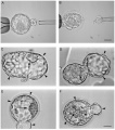 Microscopic images of human blastocysts for biopsy Z5088434 Relevant image. Reference, copyright and student template.