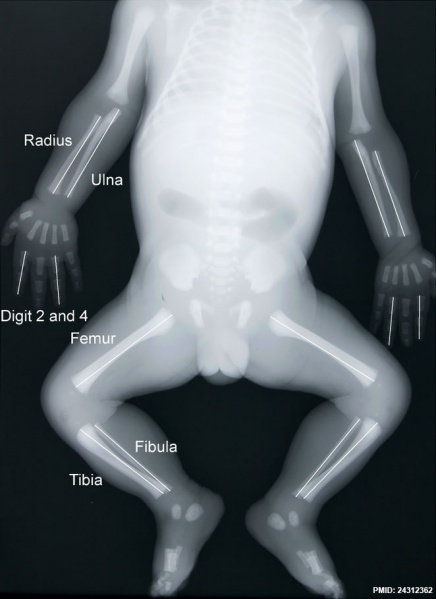 File:Human fetus skeleton x-ray 01.jpg
