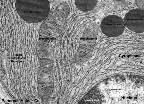 Pancreas acinar cell em01.jpg