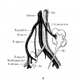 Fig. 8 Double ectopic, unrotated kidneys