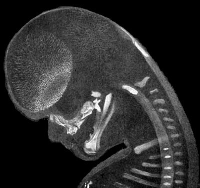 Fig.4. Head of Embryo No. 284