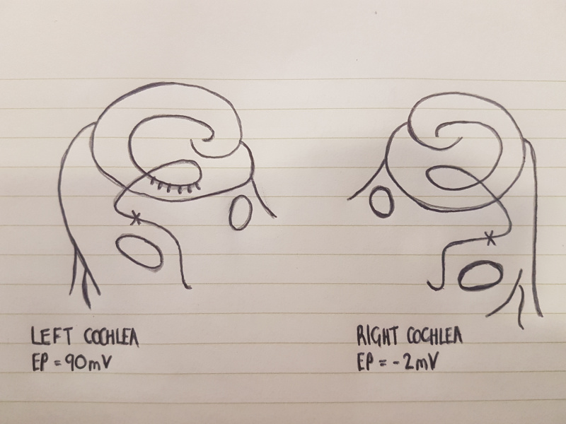 File:Left and Right Cochlea.jpeg