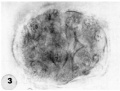3 Intact 58-cell blastocyst